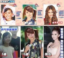 整容明星爆料综艺节目视频,综艺节目爆料大揭秘